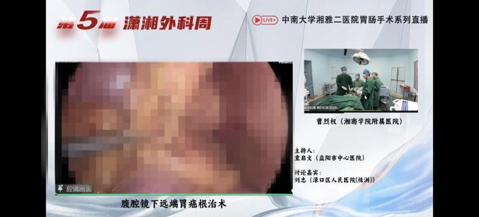 聚焦第5届潇湘外科周：我院首场手术直播精彩亮相1 (1).jpg